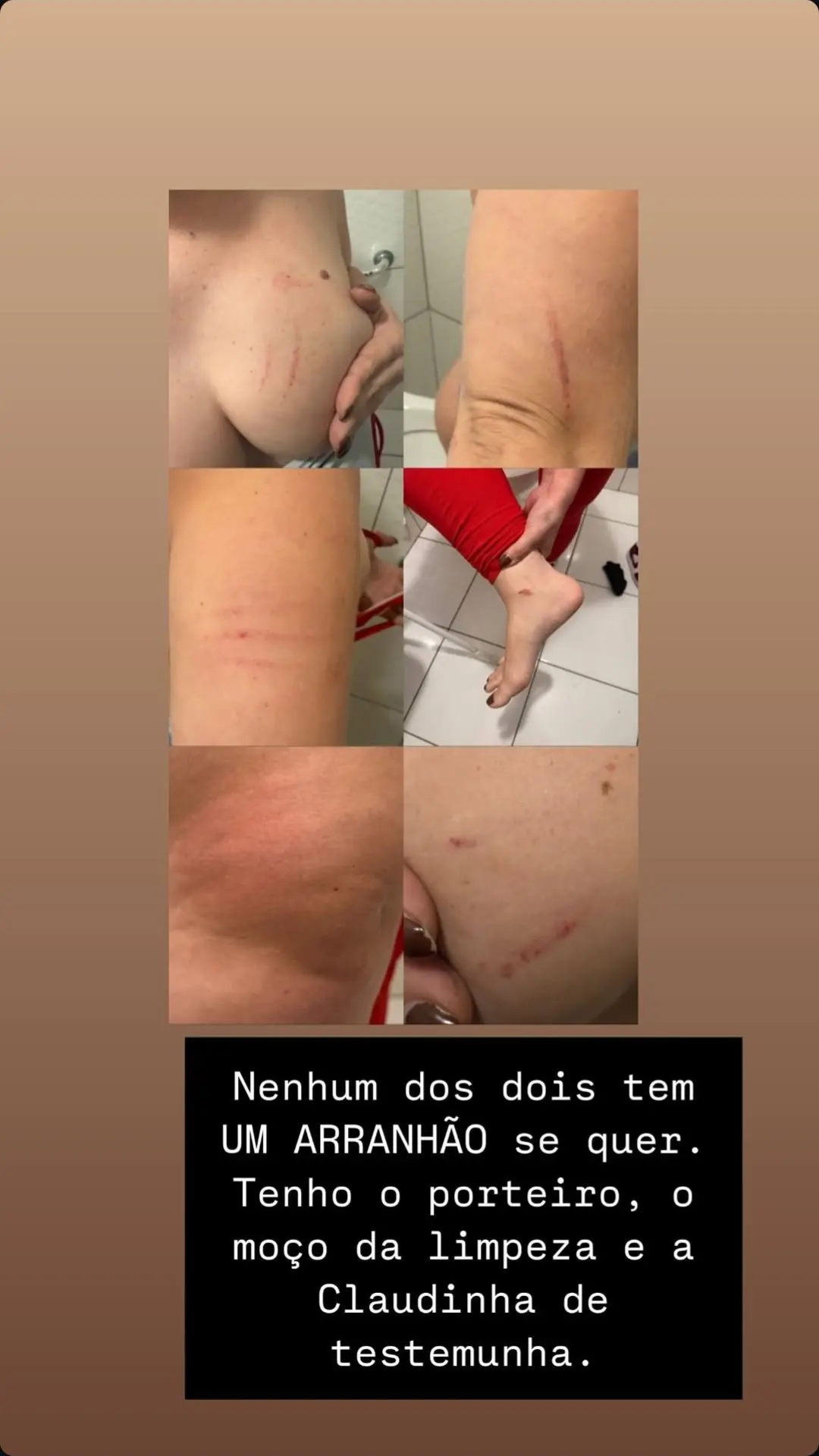“Gente, eu tô inteira machucada. Que covardia, que covardia. Ele me segurar para ela me bater”, desabafou. (Foto: Instagram)